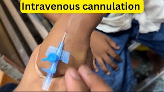 Intravenous iv Cannulation  नस में cannula लगाना सीखे  IV Cannulation  Inject cannula for vein [upl. by Samal]