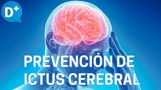 Ictus Tratamiento y prevención del Ictus cerebral [upl. by Llednohs]