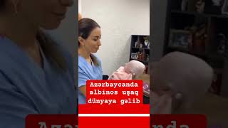 Azərbaycanda albinos uşaq dünyaya gəlib Bu barədə sosial şəbəkələrdə görüntülər yayılıb [upl. by Joseito964]