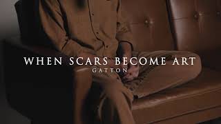 When Scars Become Art Acoustic  Gatton [upl. by Manwell]