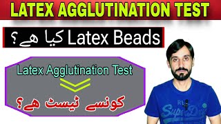 Latex Agglutination Test [upl. by Haleak]