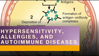 Immune System Hypersensitivities [upl. by Karney]