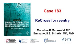 Case 183 Manual of CTO PCI  ReCross for reentry [upl. by Oyr]