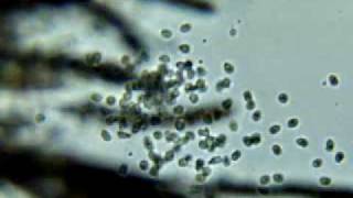 water mold zoospores [upl. by Anneres]