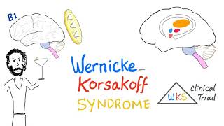 WernickeKorsakoff Syndrome WKS  Biochemistry  Diet and Nutrition [upl. by Boswall826]