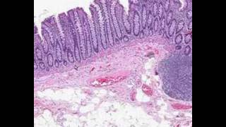 Shotgun Histology Colon [upl. by Adallard11]