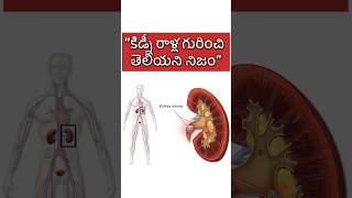 Unknown facts about kidney stones kidneystone telugufacts health [upl. by Aldis604]