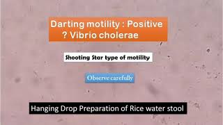 Darting Motility Positive Vibrio cholerae in Hanging Drop Preparation [upl. by Laubin]