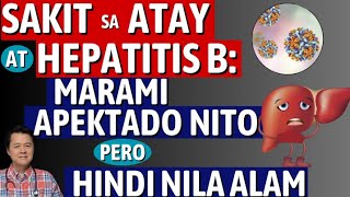 Sakit sa Atay at Hepatitis B Marami Apektado Pero Hindi Nila Alam By Doc Willie Ong [upl. by Nira]