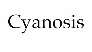 How to Pronounce Cyanosis [upl. by Eward562]