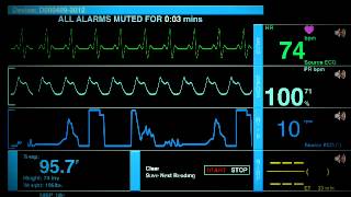 Sonido De Un Hospital [upl. by Aiykan171]