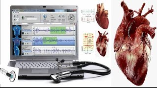 PERICARDIAL FRICTION RUB  APEX  HEART SOUNDS  AUSCULTATION  MURMUR [upl. by Eislel322]