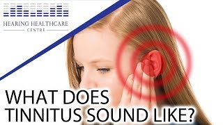 What Does Tinnitus Sound Like [upl. by Attevroc362]