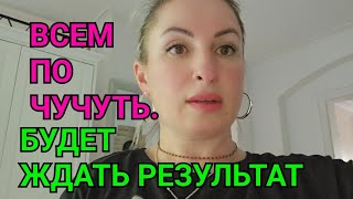 ВСЕМ ПО ЧУЧУТЬ КОГДА ВСЕГДА ВСЁ НУЖНО КОЛЬЦО ДЕЛА ЖИТЕЙСКИЕ ПРОБЛЕМЫ С ЗУБАМИ ЕВРОПА НА СВЯЗИ [upl. by Sussna]