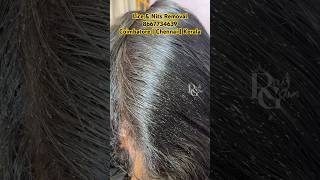 How to treat lice amp nitshow to remove lice from hairlice treatment in parlourlice removallice [upl. by Iramo]