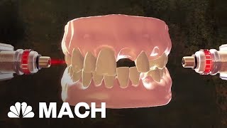 New Stem Cell Research Could Put An End To Dental Visits  Mach  NBC News [upl. by Aseuqram]