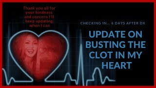 Update Eliquis Busting the Clot in My Heart Thanks for your Love amp Encouragement MPN [upl. by Lucy]