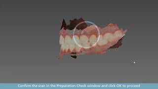 CS Imaging 31  software de aquisição do scanner intraoral CS3600 [upl. by Alakam]