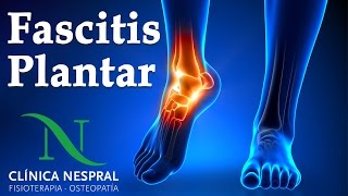 Fascitis Plantar Causas Síntomas y Tratamiento  Clínica Nespral  Fisioterapia y Osteopatía [upl. by Rolyt204]