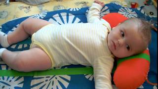 Evan six months infantile spasms  West Syndrome [upl. by Adora]