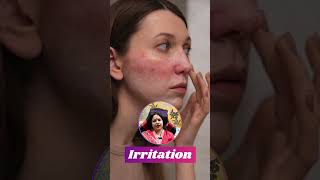 Struggling with Oily Skin Simple Solutions  Dr Shruti Kohli dermatologist oilyskin skincare [upl. by Urbannai]