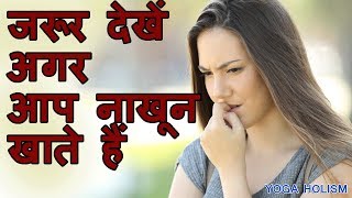 जरूर देखें अगर आप नाखून खाते हैं  Nail Biting Habit Causes and Cures [upl. by Silvano]