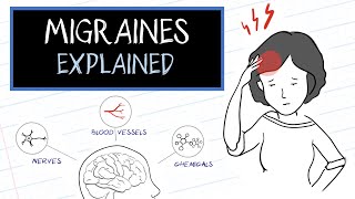 What are Migraines HealthSketch [upl. by Yelsnya355]