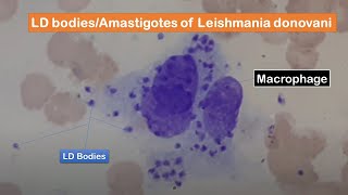 LD bodies Amastigotes of Leishmania donovani in skin smear of a cutaneous leishmaniasis patient [upl. by Fay494]