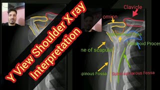 Y ViewLateral View X Ray Shoulder anatomy Interpretation with 3D markers and SubtitlesNLEPMDC [upl. by Flynn386]