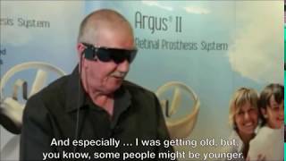 Argus II Manchester User Testimonial  Artificial Retina  Bionic Eye [upl. by Acitel840]