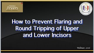 How to Prevent Flaring and Round Tripping [upl. by Osnofedli568]