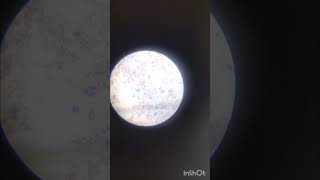 gram staining  bacteria under microscope [upl. by Ahseekal]