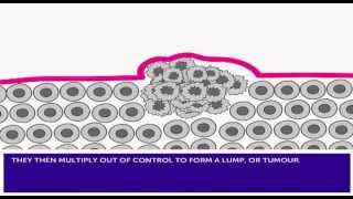 How Cancer Develops amp Mutation [upl. by Uri16]