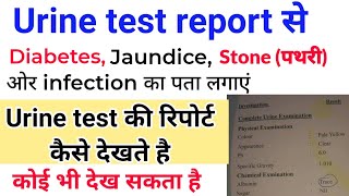 urine test report देखना सीखे  Urine test report कैसे देखते है  Pus cell  Protein  Sugar Cast [upl. by Kariv560]