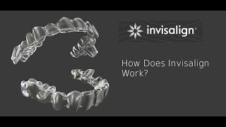 Invisalign clear aligners  how it works  wwwbangkokbracescom [upl. by Nauwtna]