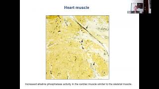 Myositis and Heart Disease with Dr Christina CharlesSchoeman [upl. by Adelind]