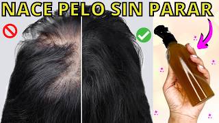 ✅SE TE CAE EL PELO👉 USA ESTE REMEDIO POTENTE EN LA SEMANA Y TU CABELLO NO PARARA DE CRECER😱 [upl. by Elwee]