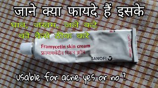 Framycetin Skin Cream hindi review  घाव जखम  जले कटे को ठीक करे ।। जाने कैसे use करे [upl. by Luigino]