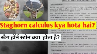 Staghorn calculus kya hota haiस्टैग हॉर्न स्टोन क्या होता है [upl. by Gelya]