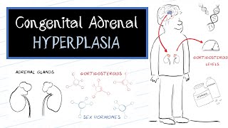 What is Congenital Adrenal Hyperplasia CAH [upl. by Ainecey]