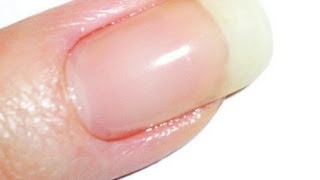 Vitagel LEDUV Gel to Repair Cracked Nails [upl. by Eintirb]