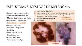 Dermatoscopia de las lesiones melanocítica benignas y malignas [upl. by Annocahs]