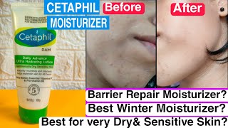 CETAPHIL Daily Advance Ultra Hydrating Lotion Review✅Best Winter Moisturizer For Dry Skin [upl. by Anaile]