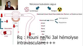 9Mecanismes nécrose tubulaire aigue [upl. by Giess]