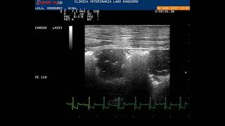 Lung ultrasound 10 MHz linear probe showing subpleural nodular lesions which are the typical probe [upl. by Sgninnej]