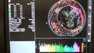 Video 1  KLATencor Surfscan 6200 Defect Inspection System ID 3744 [upl. by Vogel]