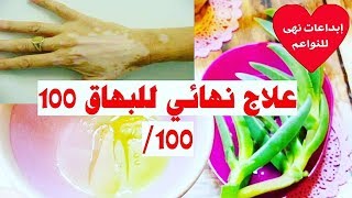 دواء للبهاق مجرب وناجح 100100وداعا للبهاق [upl. by Coppins676]