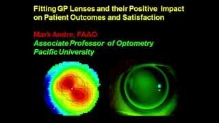 Fitting GP Lenses Part 1  Mark Andre [upl. by Aihsem]