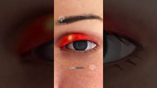 Whats REALLY Causing Your Eye Stye 😮 shorts viralvideo  Creativelearning3d [upl. by Nahgeam]