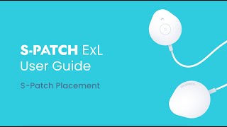 SPatch ExL User Guide SPatch Placement [upl. by Salas]